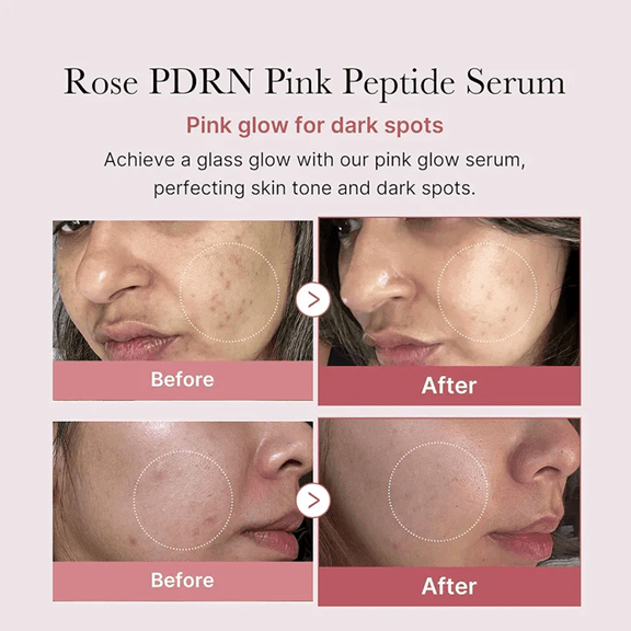 Medicube PDRN pdrn Pink Peptide Serum 30ml - Beauty Glams