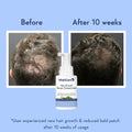 WishCare Hair Growth Serum Concentrate - Beauty Glams