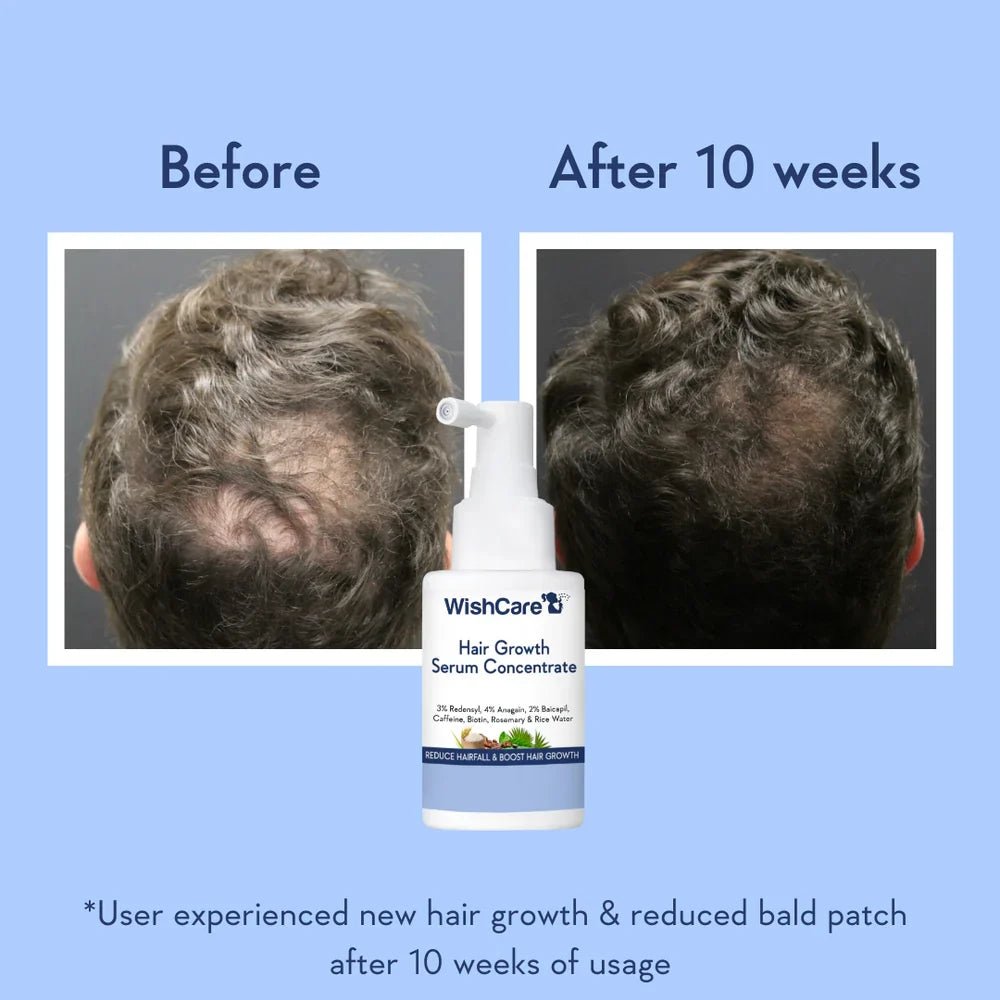 WishCare Hair Growth Serum Concentrate - Beauty Glams