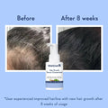 WishCare Hair Growth Serum Concentrate - Beauty Glams