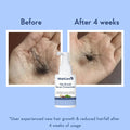 WishCare Hair Growth Serum Concentrate - Beauty Glams
