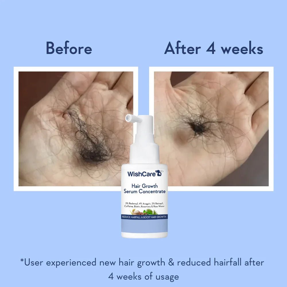 WishCare Hair Growth Serum Concentrate - Beauty Glams